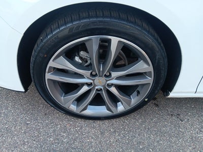 2025 Chevrolet Malibu LT w/1LT